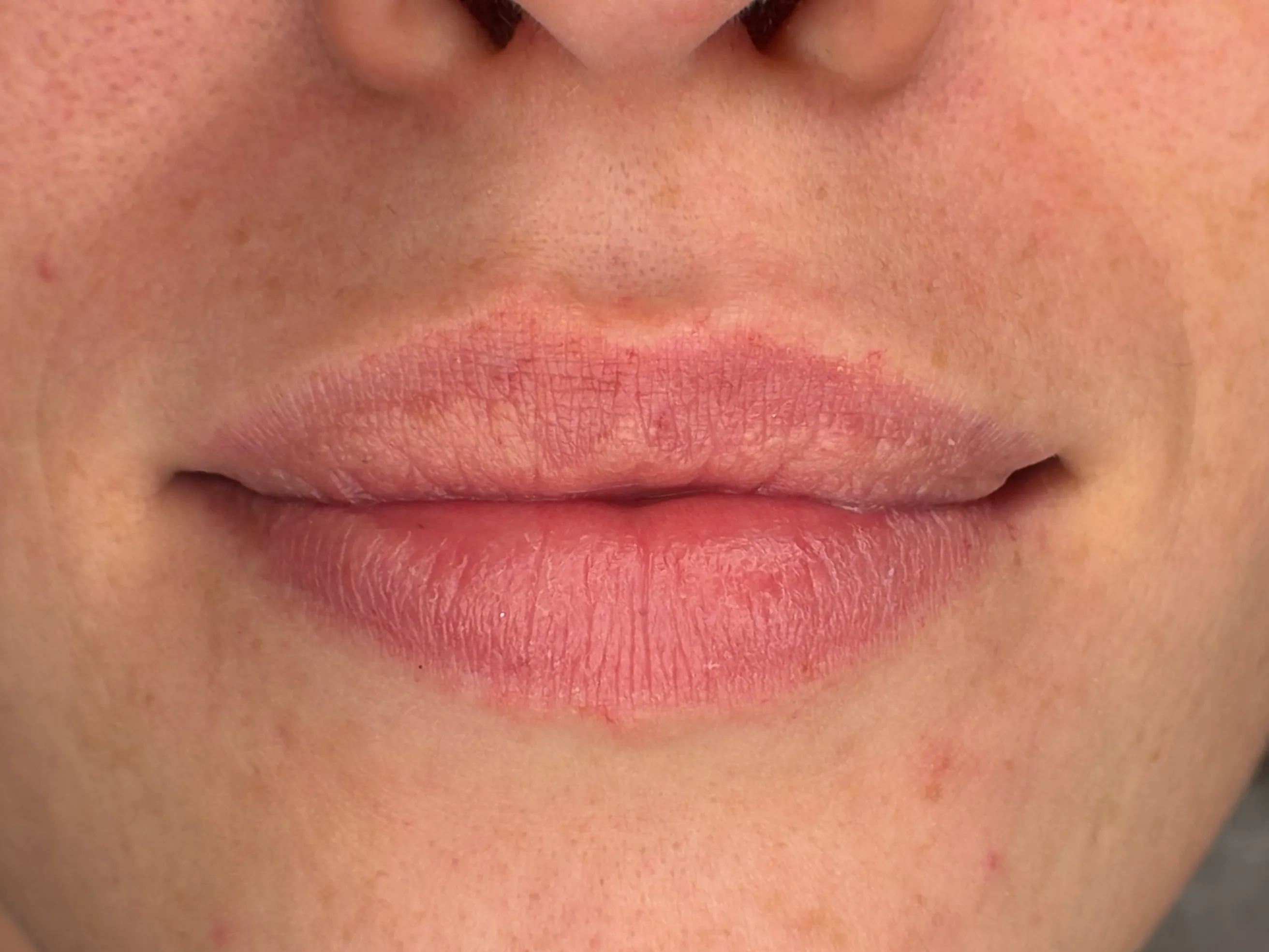 Lippen vor der Lip Blush Behandlung