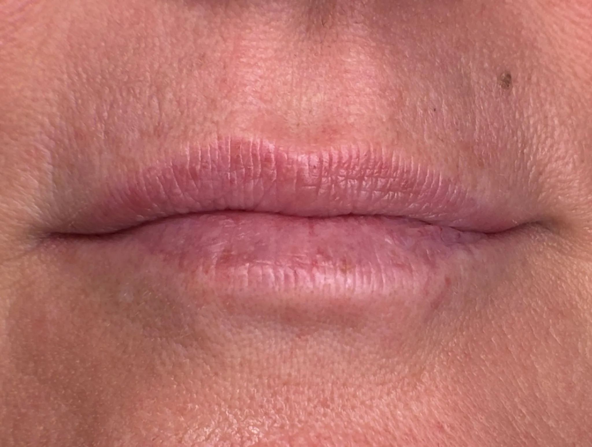 Lippen vor der Lip Blush Behandlung