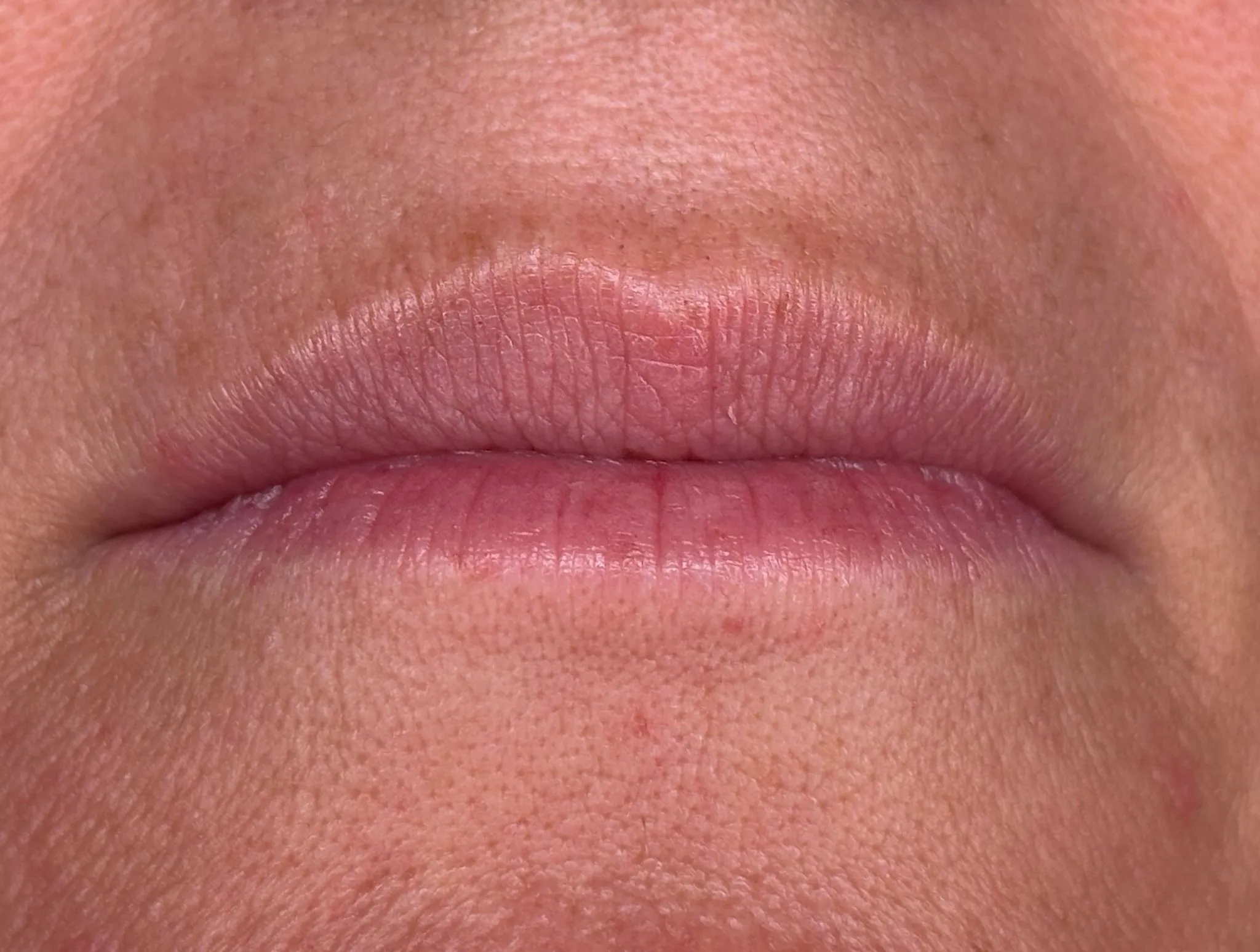 Lippen vor der Lip Blush Behandlung